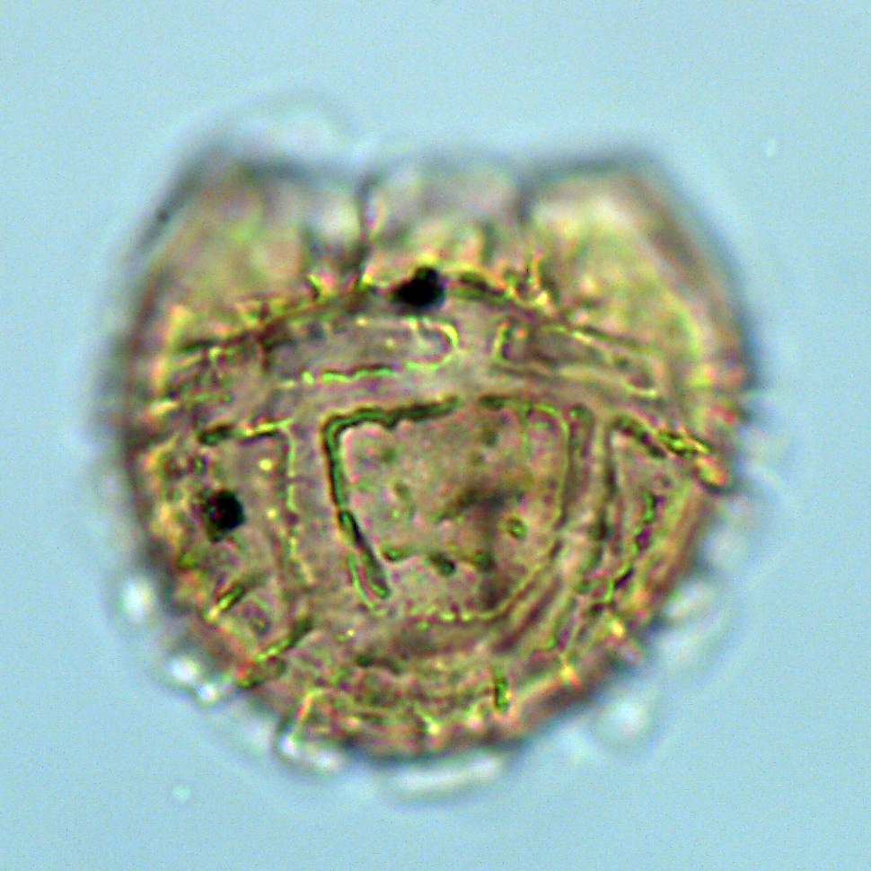 Alisocysta margarita, U1581-19R-1W, 38-42, sl. 1, U23-3, foto-c.jpg